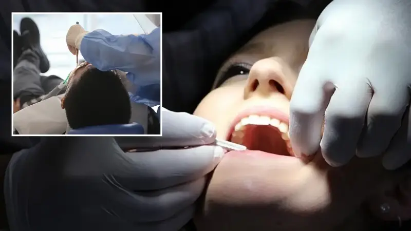 İlerleyen diş çürüğü sistemik hastalıkları tetikleyebilir