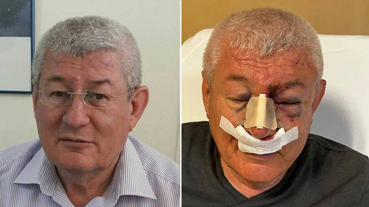 Uşak’ta SOL Parti İl Sözcüsü Mahmut Uludağ’a Saldırı Gerçekleşti
